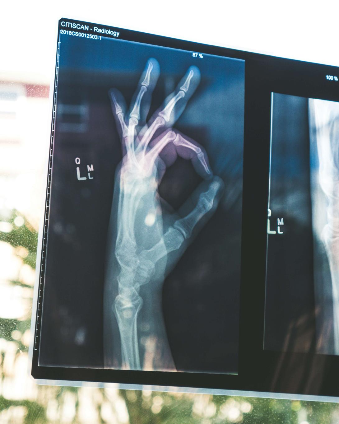 hand radiology